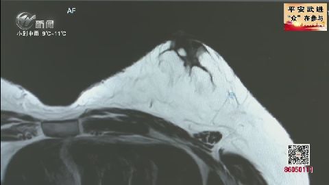 武進新聞
